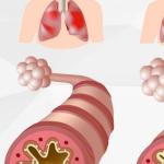 How To Survive An Asthma Attach Without an Inhaler